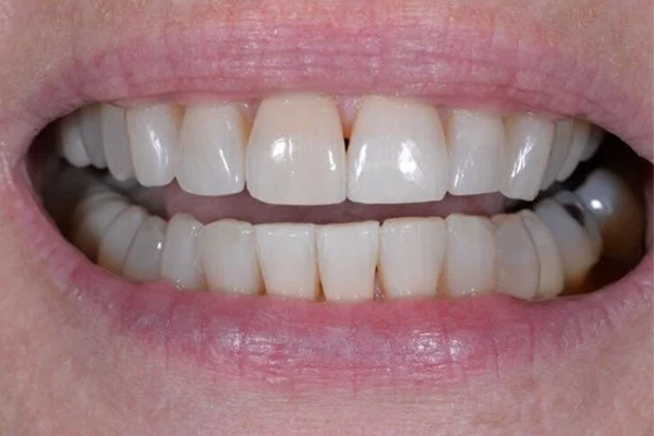 Zoom After Case B Dr. Angela Ferrari