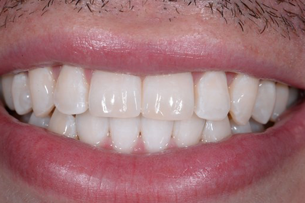 Zoom After Case C Dr. Angela Ferrari