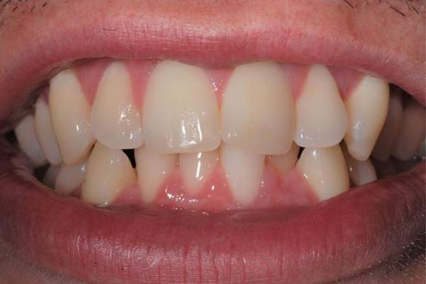 Zoom Before Case C Dr. Angela Ferrari