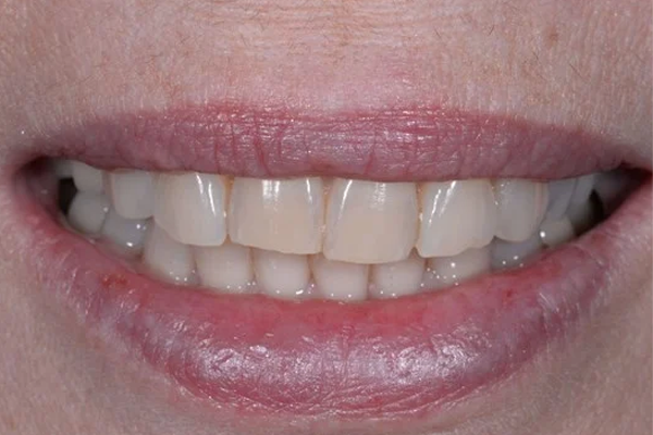 Zoom Before Case E Dr Angela Ferrari