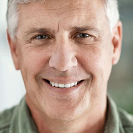 full mouth reconstruction