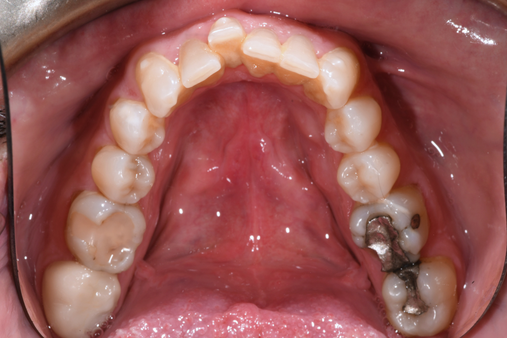 before smile makeover
